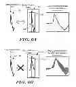 Fig. 06 - Methods and devices for accurately classifying cardiac activity