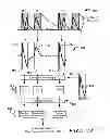 Fig. 07 - Methods and devices for accurately classifying cardiac activity
