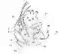 Fig. 01 - Device for assessment and therapy of temporal ventricular desynchronization
