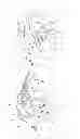 Fig. 02 - Device for assessment and therapy of temporal ventricular desynchronization