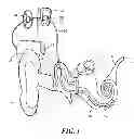 Fig. 02 - Implant Sensor and Control