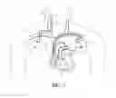 Fig. 03 - Remote sensing in an implantable medical device