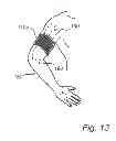Fig. 09 - Light-emitting device and photo-therapy device comprising a light-emitting device