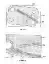 Fig. 05 - Electrically conductive implantable medical device