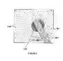 Fig. 06 - Electrically conductive implantable medical device