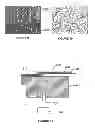 Fig. 08 - Electrically conductive implantable medical device
