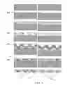 Fig. 10 - Electrically conductive implantable medical device