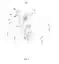 Fig. 02 - Pinch to open cuff electrode