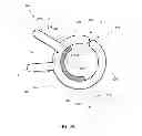 Fig. 04 - Pinch to open cuff electrode