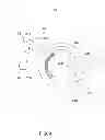 Fig. 07 - Pinch to open cuff electrode