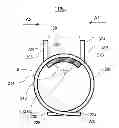Fig. 01 - Pinch to open cuff electrode