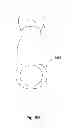 Fig. 07 - Pinch to open cuff electrode