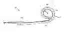 Fig. 01 - Mid-scalar electrode array