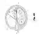 Fig. 06 - Mid-scalar electrode array
