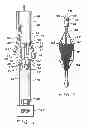 Fig. 02 - Over-the-wire interlock attachment/detachment mechanism