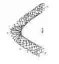 Fig. 12 - Vascular stenting for aneurysms