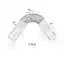 Fig. 32 - Vascular stenting for aneurysms