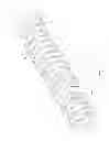 Fig. 05 - Expandable slide and lock stent