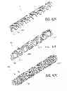 Fig. 35 - Expandable slide and lock stent