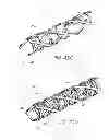 Fig. 37 - Expandable slide and lock stent