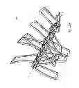 Fig. 40 - Expandable slide and lock stent