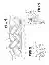 Fig. 02 - RADIOPAQUE MARKER FOR VASCULAR DEVICES