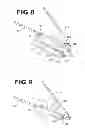 Fig. 04 - RADIOPAQUE MARKER FOR VASCULAR DEVICES