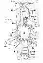 Fig. 01 - Vascular endograft