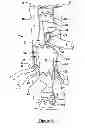 Fig. 02 - Vascular endograft