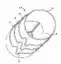 Fig. 01 - Prosthetic heart valve systems