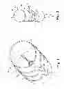 Fig. 02 - Prosthetic heart valve systems