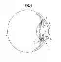 Fig. 05 - INTRAOCULAR LENS AND METHOD