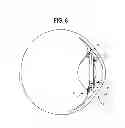 Fig. 07 - INTRAOCULAR LENS AND METHOD
