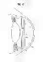 Fig. 16 - INTRAOCULAR LENS AND METHOD