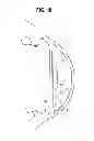 Fig. 19 - INTRAOCULAR LENS AND METHOD
