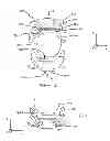 Fig. 02 - Intraocular lens