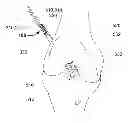 Fig. 01 - Graft fixation device