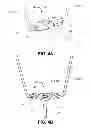 Fig. 07 - Graft fixation device