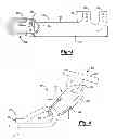 Fig. 03 - Scaffold for spring ligament repair