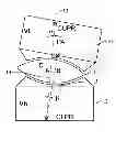 Fig. 01 - Vertebral disc prosthesis