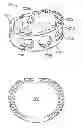 Fig. 01 - Stand-alone interbody fixation system