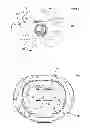 Fig. 03 - Stand-alone interbody fixation system