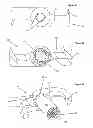 Fig. 09 - Stand-alone interbody fixation system