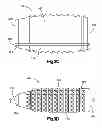 Fig. 07 - Interbody fusion implant