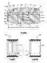Fig. 08 - Interbody fusion implant
