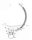 Fig. 01 - Spacer and expanding device