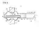 Fig. 07 - Spacer and expanding device