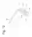 Fig. 13 - BONE FIXATION AND FUSION DEVICE
