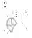 Fig. 25 - BONE FIXATION AND FUSION DEVICE