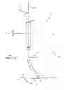 Fig. 02 - Femoral prosthesis with insertion/extraction feature